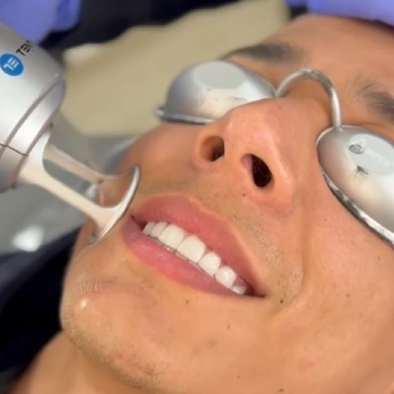 tratamiento-laser-co2-cemetri-1