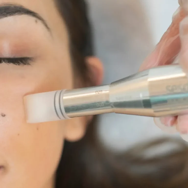 tratamiento-nanopore-cemetri